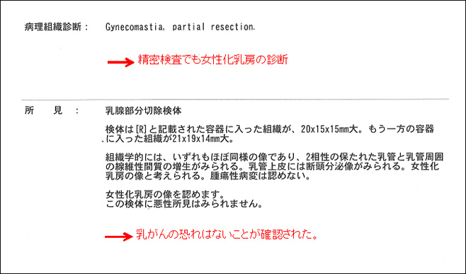 女性化乳房修正術症例№11精密検査の結果