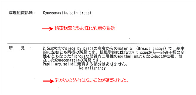 女性化乳房修正術症例№18精密検査の結果