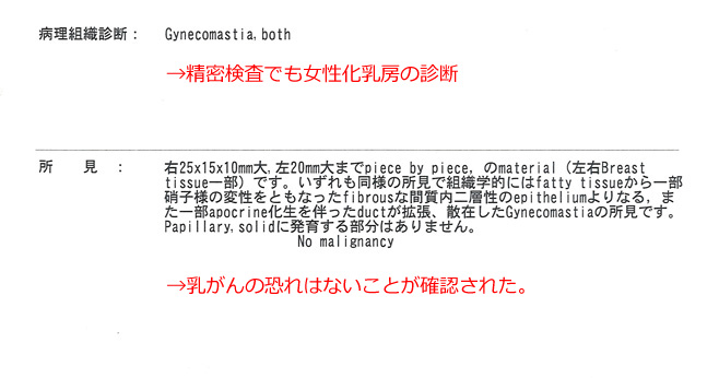 女性化乳房修正術症例№20精密検査の結果