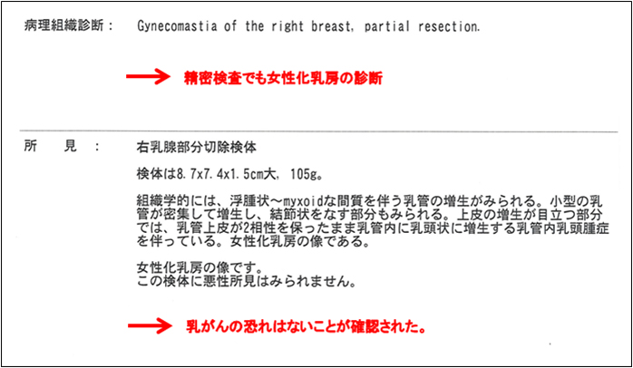 女性化乳房修正術症例№05精密検査の結果