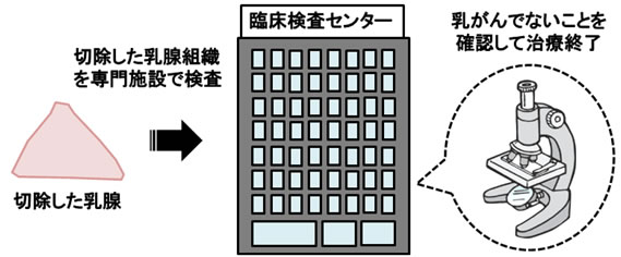 女性化乳房手術方法のイメージ７